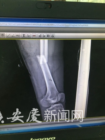 微信图片_20220613103855.png