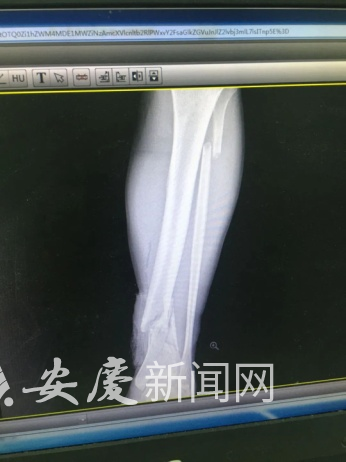 微信图片_20220613103855.png